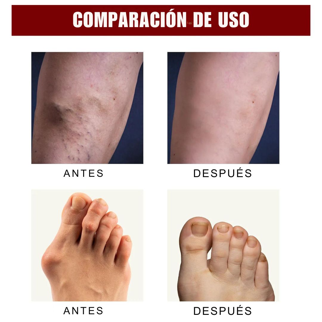 Perfectx® Crema Terapia ¡Alivio y recuperación garantizados para tus articulaciones y huesos! (Pague 1, lleve 2)