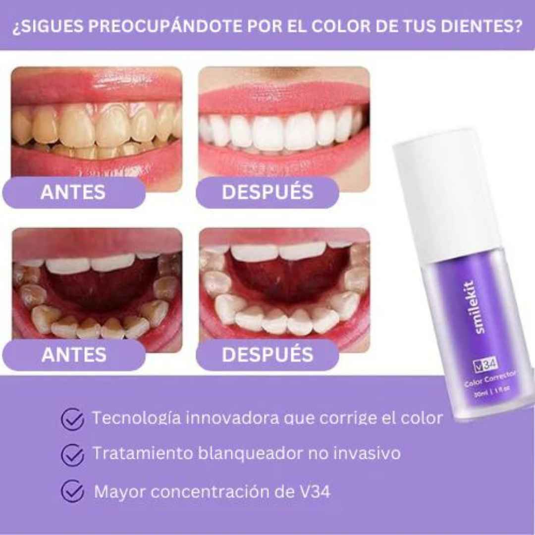 Blanqueador Dental HiSmileKit™ - Compra 1 Recibe 2 😮 ¡Potencia el brillo de tu sonrisa!