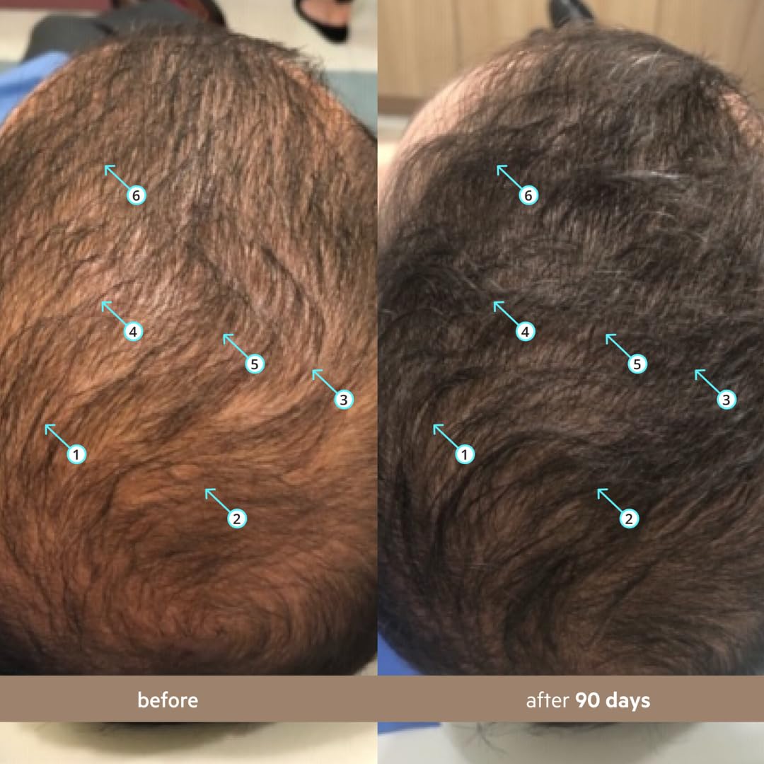 Spectral - Suero de densidad de cabello para hombre
