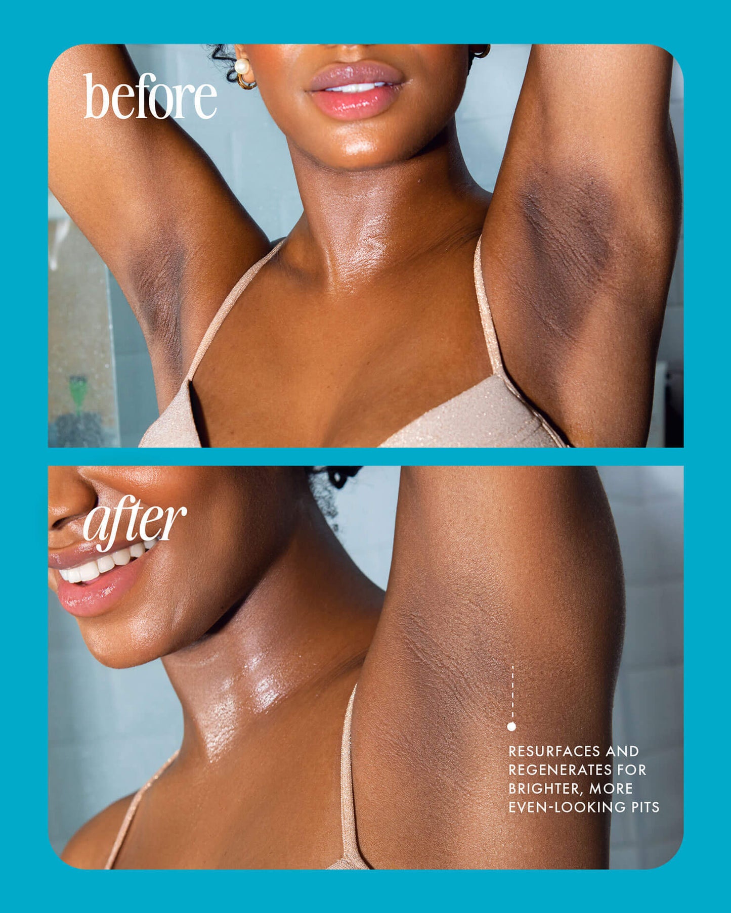 Truly® Jelly Booster Serum Despigmentante