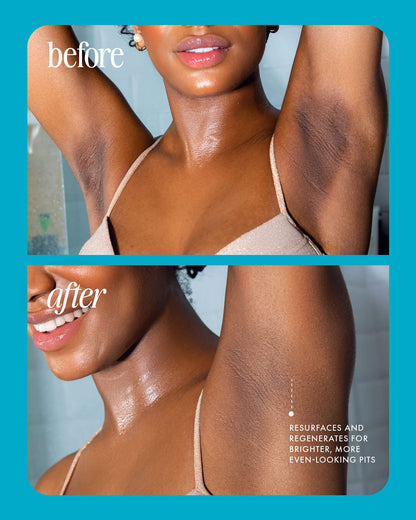 Truly® Jelly Booster Serum Despigmentante