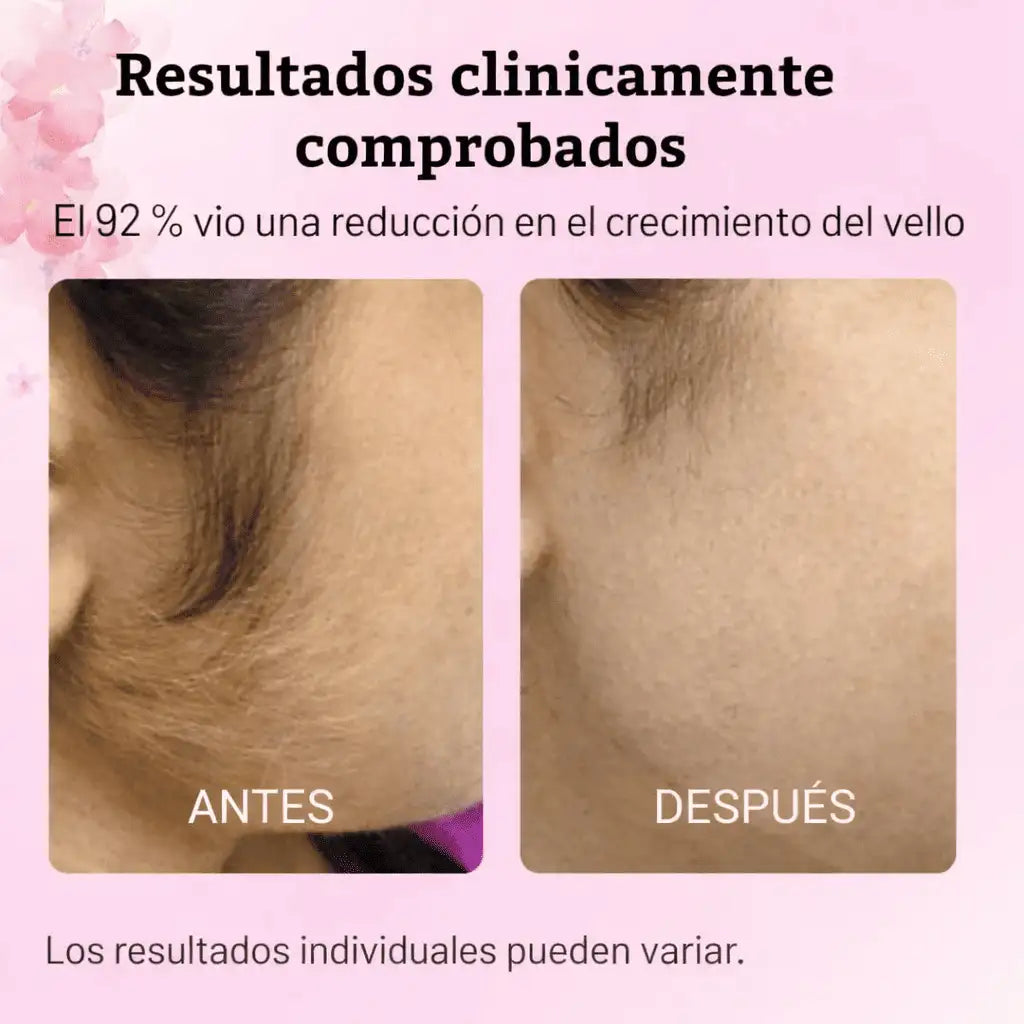 Caramela Cyperus® Serum natural  60 ml🌿 Reduce el crecimiento del vello corporal