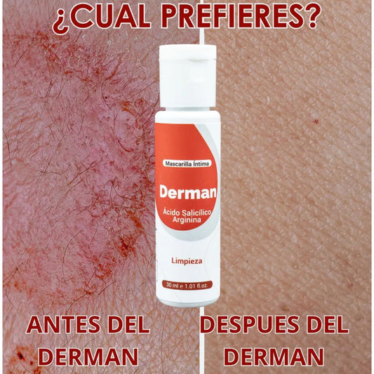 Derman® Crema íntima para hongos y bacterias