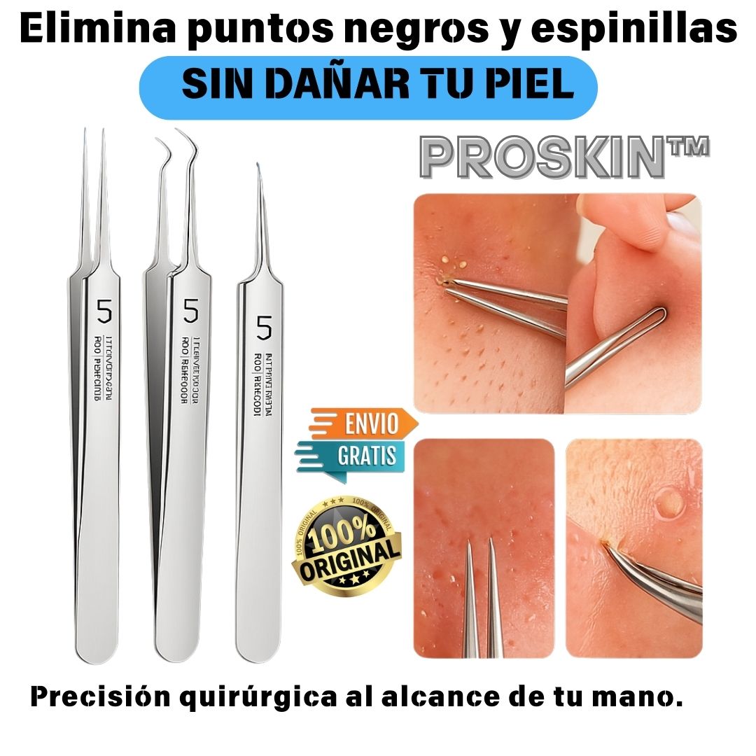 Kit de pinzas para puntos negros y espinillas ProSkin™