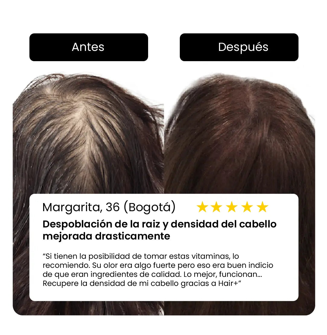 Hair+ Bigvita Suplemento para el crecimiento del cabello